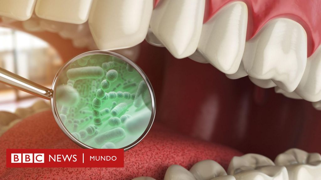 4 diseases linked to the bacteria in your mouth