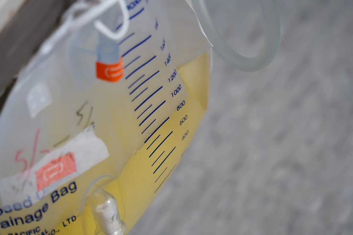 Problems with the supply of urine bags needed by patients such as those with spinal cord injuries are getting worse.