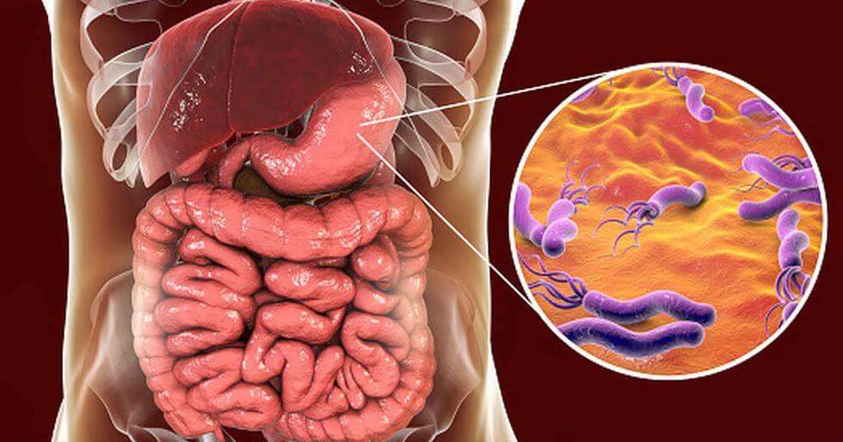 What are the data revealed by the Argentine study on a bacteria that causes everything from gastritis to cancer?