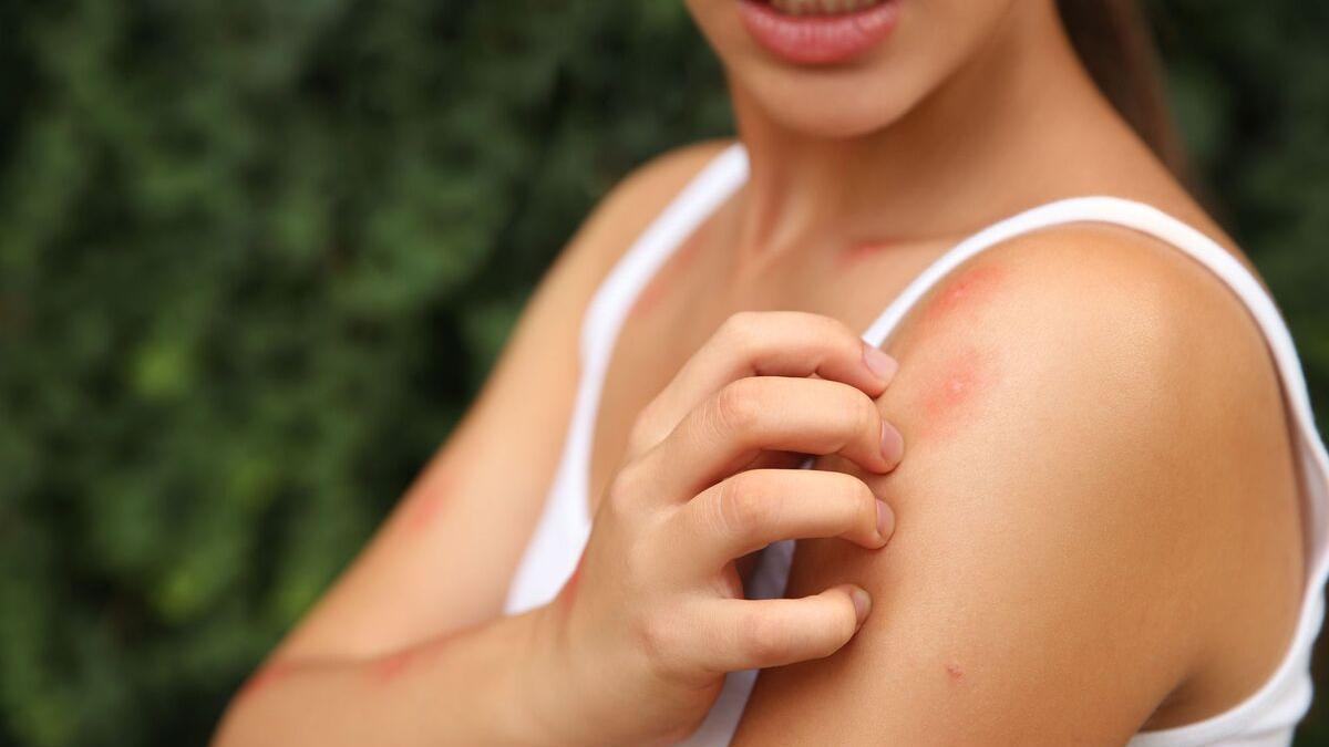 DERMATOLOGY: Neither wart nor mosquito bite: it is skin cancer and very aggressive