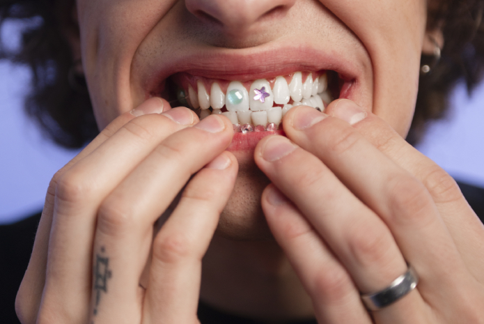 Dental grillz, are they harmful to oral health?