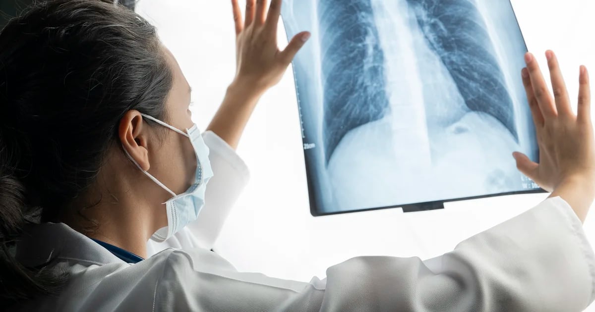 How is the treatment for lung cancer that prolongs the lives of patients?