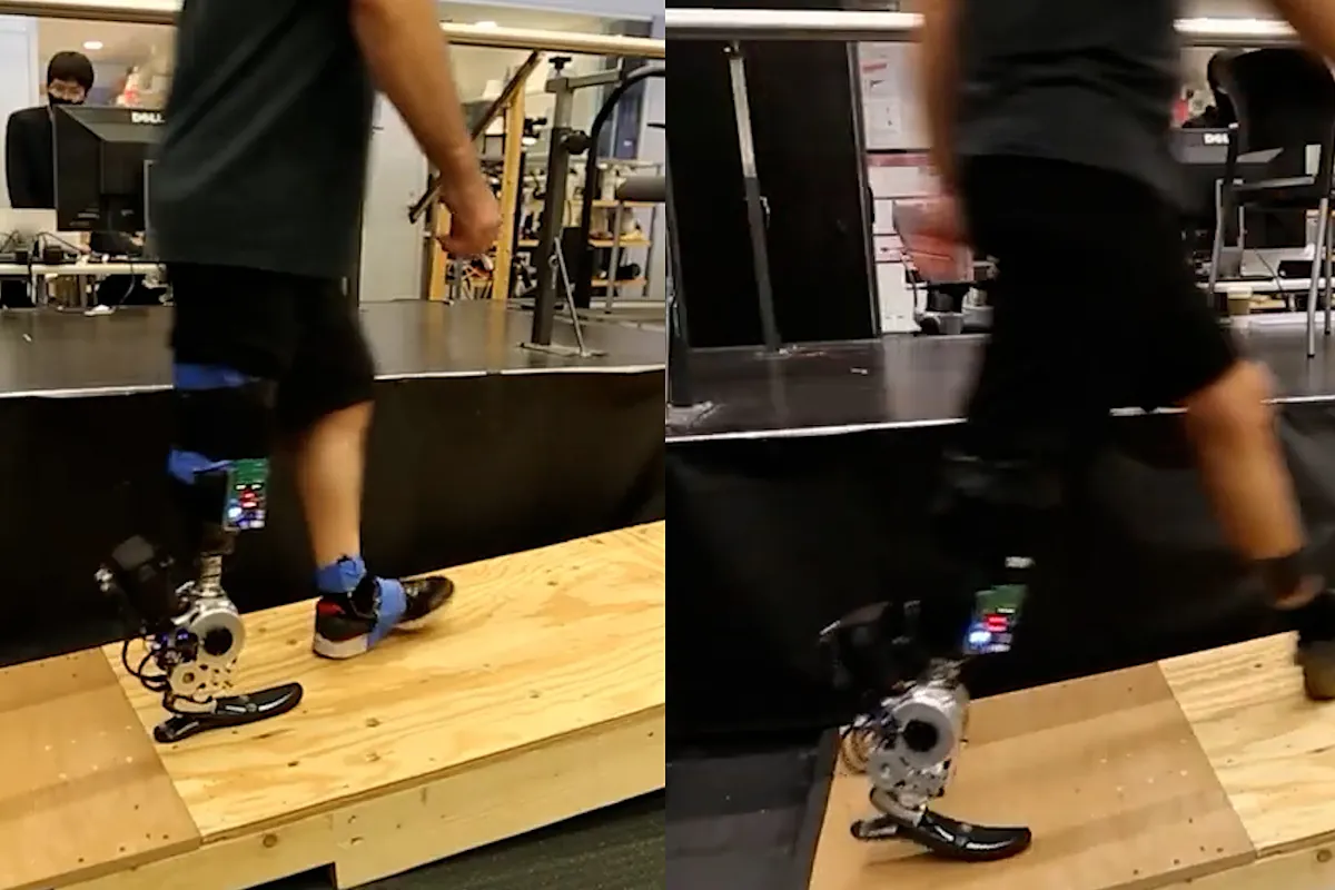 A new binic leg allows amputees to imitate the natural gait
