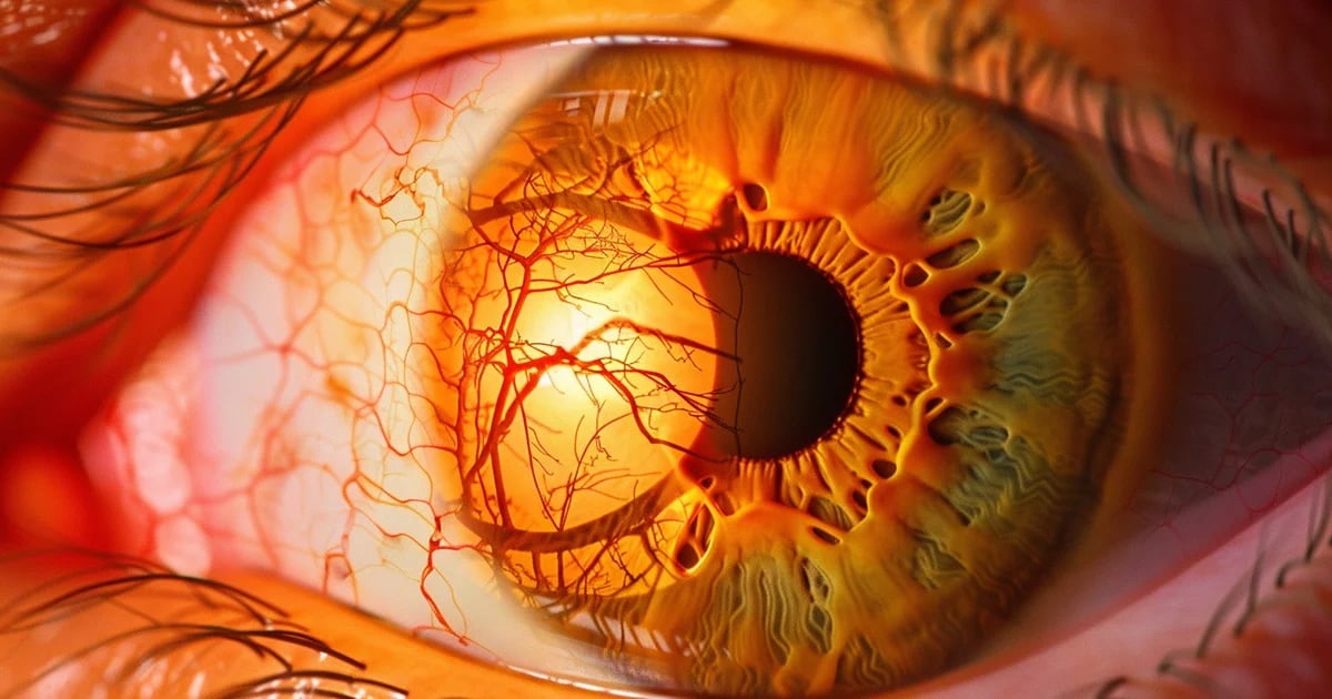 The vision disease associated with diabetes that most patients are unaware of