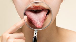 What does your tongue tell us about our health? If it is this color, you should see a doctor