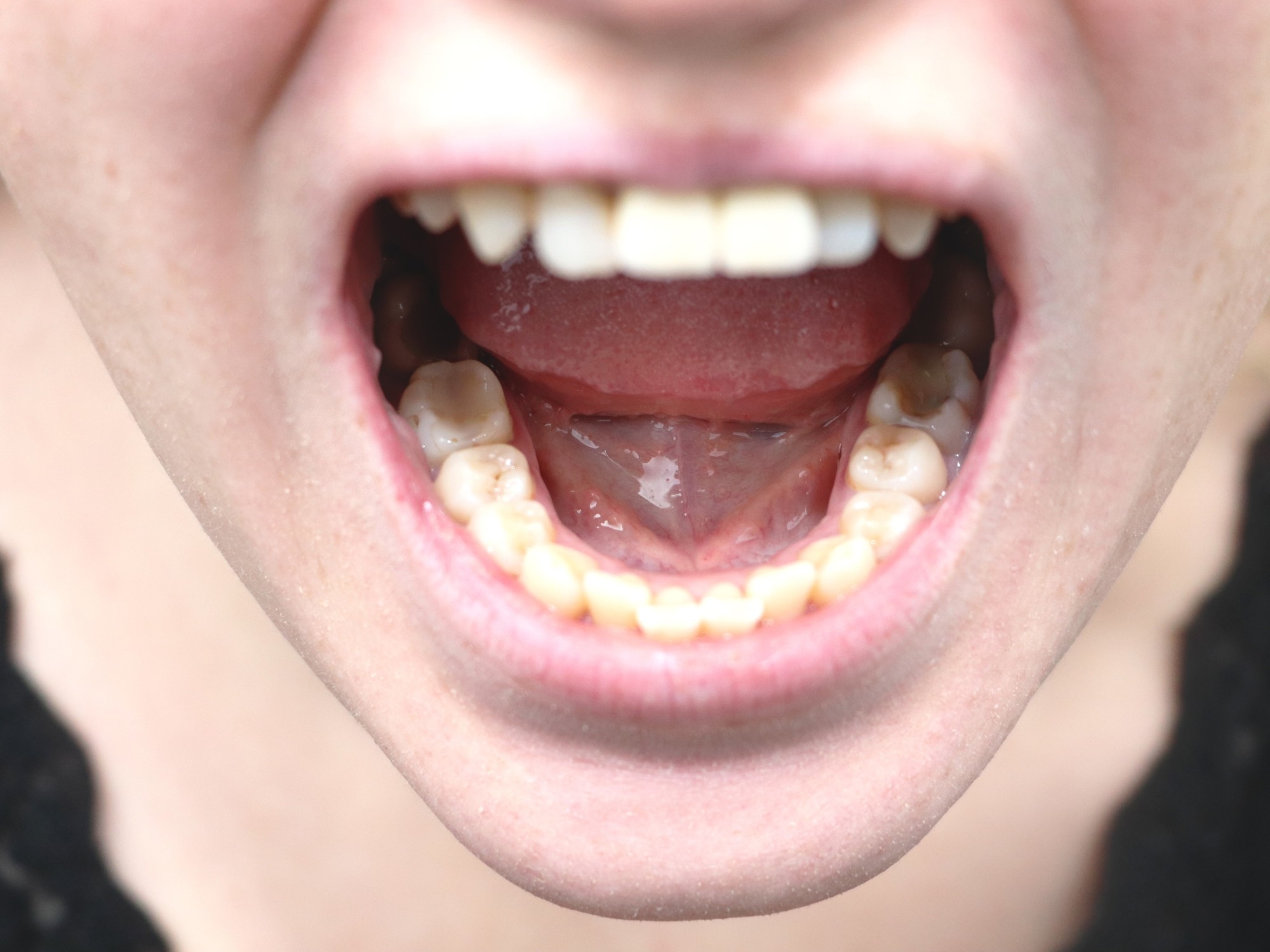 What signs in the mouth and throat should not be ignored?